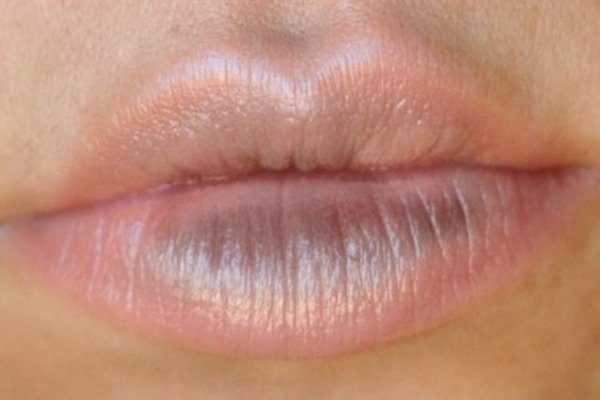 Dark Lip